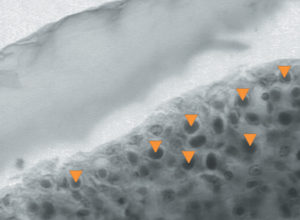 Temperature effects on shrimp survival to disease