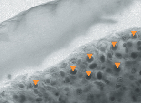 Article image for Temperature effects on shrimp survival to disease