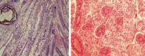 Loose shell syndrome causes low-level mortality in India’s black tiger shrimp