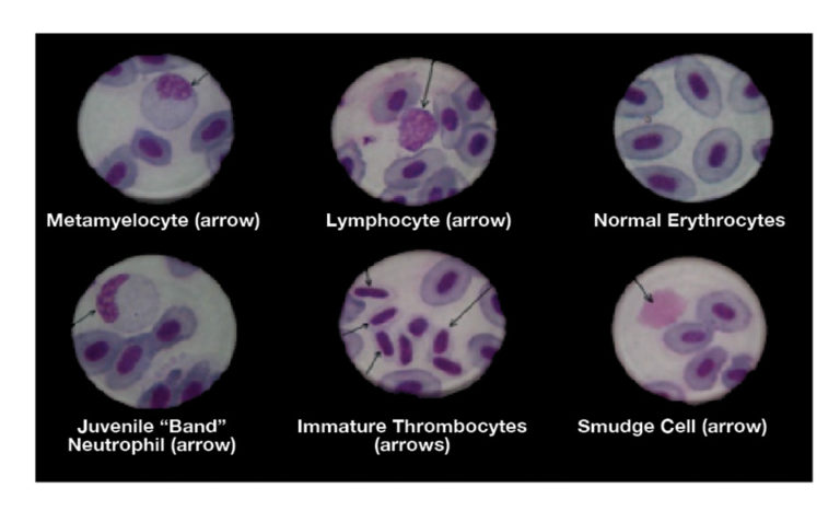 Article image for How to prepare and interpret blood smears