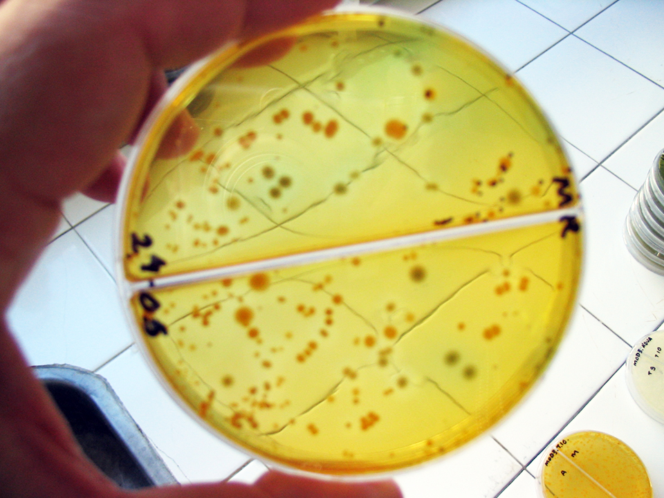 Article image for Flaws in reporting antimicrobial resistance