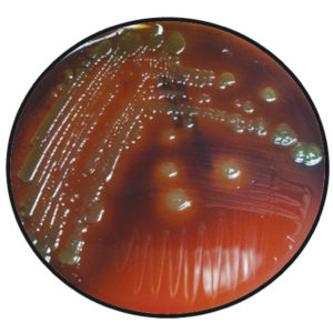 Field diagnostic tools for pathogenic vibrios