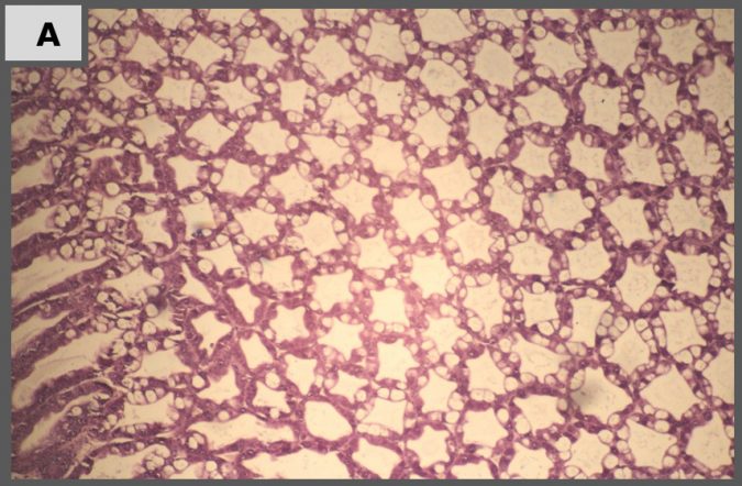 Fig. 4A: Control negativo: histología normal de hepatopáncreas, con tipos de células diferenciadas, células B-notables con vacuolas. 