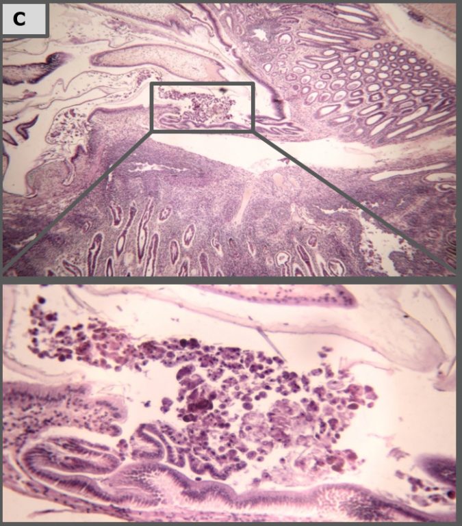 Fig. 4C: Control positivo (10 dpi): infiltración hemocítica severa alrededor de túbulos de hepatopáncreas, desprendimiento de células del hepatopáncreas al estómago combinada con la pérdida de tipos de células (células B-, F- y R-). 