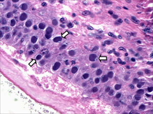 New WSSV, TSV genotypes identified in Saudi Arabia