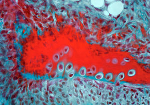 Research supports healthy fish skeletons