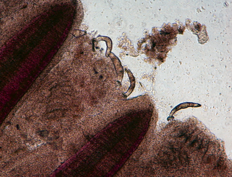 Article image for Parasitism enhances susceptibility to bacterial infection in tilapia