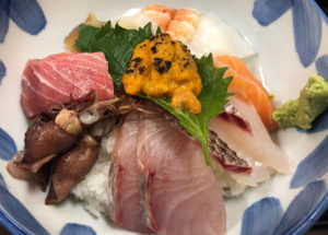Analysis of global diets highlights persistent undernutrition