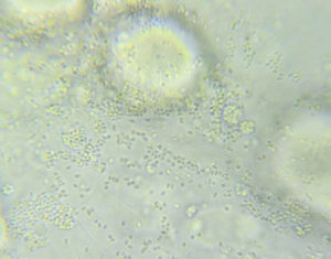 In vitro evaluation of two commercial biocides on EHP spore extrusion rate