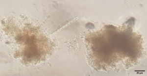 Effect of aeration on the development of the microbial community in shrimp biofloc technology systems
